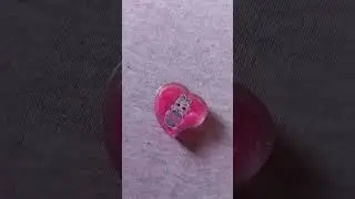 LOL