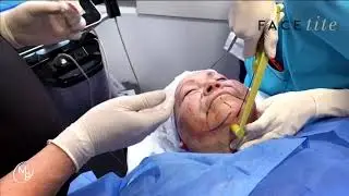 Facetite - Dra. Monica Pineda