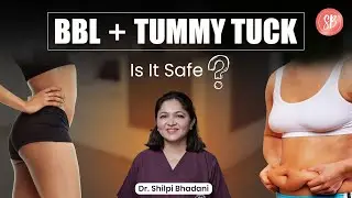 Can I have a Tummy Tuck and a BBL together? | Should I get Tummy Tuck or BBL? | SB Aesthetics