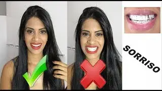 Dicas para ter um sorriso bonito