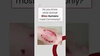 What Animal BITES Humans the Most? 