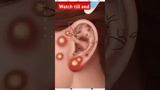 ear cleaning asmr animation👂🏻ear cleaning asmr shorts