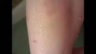 Domestic Violence IN THE FLESH
