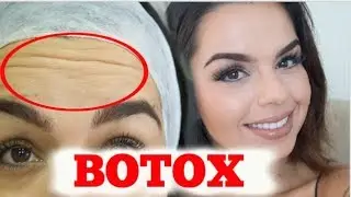 BOTOX FACIAL : VALOR, DURAÇÃO, DOR E PROCEDIMENTO