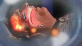 See What A Sleep Apnea Episode Looks Like