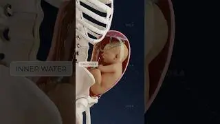 What is mixed breech presentation and why is cesarean recommended? Obstetrics in 3D with VOKA