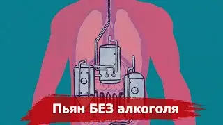 Drunk WITHOUT alcohol or what is Autobrewery Syndrome