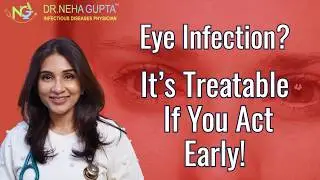 Eye Infections I #Cellulitis#Syphilis# HIV#TB# Viral#Fungal  I NG Swastha #infectiousdiseases