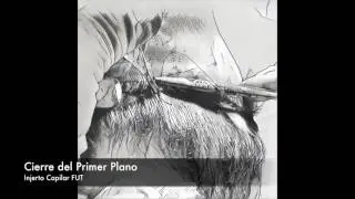 Proceso Injerto Capilar FUT (Técnica Tira). PISANO® Hair Transplant Clinic