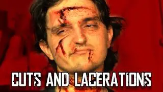 Cuts and Lacerations: Mad Monster Lab