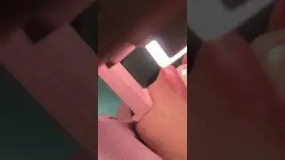 Tips and tricks angle position dental photography with lamp u for mobilephone