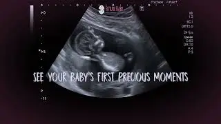 Stay Connected From the Beginning | Live Reassurance Baby Scans at Our Studio