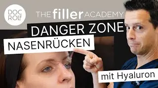 NASENKORREKTUR mit HYALURON: Hör auf DAS zu machen!!