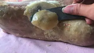 How to removal skin | callus removal skin flakes #36