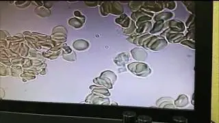 Наблюдение под микроскопом действие на иммунитет спреев Alivemax !