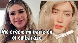 Mi nariz crecio en el embarazo