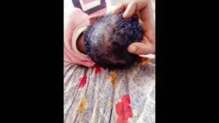 Use RADIANT HAIR CREAM  to grow your hair.