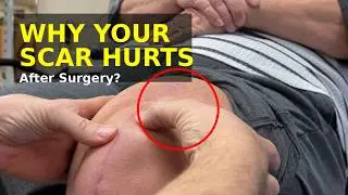 Scar Massage INCREDIBLE 8-Weeks After Knee Replacement