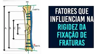 Entenda quais são os fatores que influenciam na rigidez da fixação de fraturas