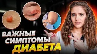 ЭТО ГЛАВНЫЕ признаки начинающегося диабета! Как распознать болезнь