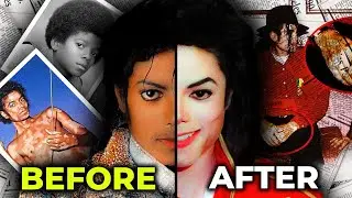 The REAL Reason Why Michael Jackson's Skin Turned White | MJ Forever