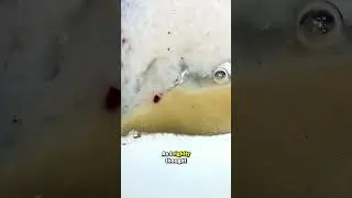 Sausage Meat Under The Microscope 1000x