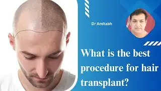 What is the best procedure for hair transplant? | Patient education I MIC