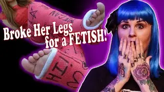 She Broke Her Own Legs for Her Man's Fetish