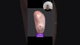 Желудок человека. Анатомия