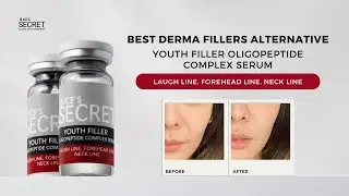 Best Derma Filler Alternative | Youth Filler Oligopeptide Complex Serum: Laugh line, Forehead Line