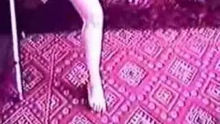 Amputee Lena 2