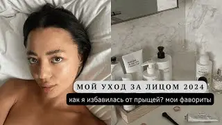 МОЙ УХОД ЗА ЛИЦОМ/КАК ИЗБАВИТЬСЯ ОТ ПРЫЩЕЙ?