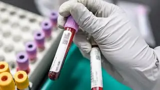 Clinical Updates on Thrombotic Thrombocytopenic Purpura (TTP)