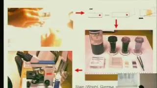 CellScope: Mobile Imaging for Disease Diagnosis