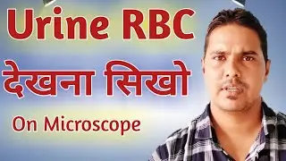 Urine rbc under microscope | How to identify urine rbc | How to count urine rbc