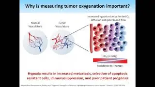 November 2016 Webinar: Photoacoustic Imaging of Tumor Oxygenation: Validation with MRI