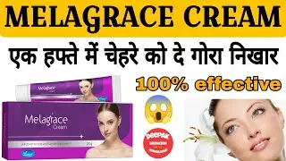 Melagrace Cream Review In Hindi || एक हफ्ते में चेहरे को दे गोरा निखार । #MelagraceCream