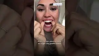 ¿Tu Tratamiento de Ortodoncia Invisible tiene ELÁSTICOS? 🤔⁣ ¡Esto te interesa!