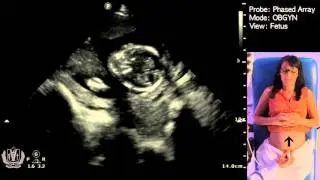 Obstetric Ultrasound Basics with Fetal Heart Rate Calculation​ - Made Simple