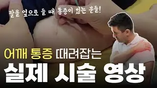 어깨가 아플 때 도움이 되는 실제 시술 영상!