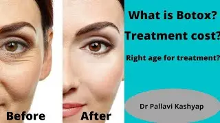 What is Botox ? || Treatment cost || Age || Dr pallavi Kashyap || Hindi ||
