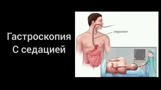 эндоскопия с седацией