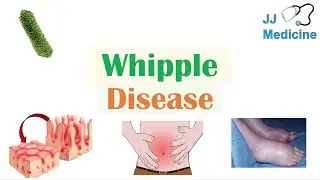 Whipple Disease | Causes, Risk Factors, Pathophysiology, Symptoms, Diagnosis, Treatment
