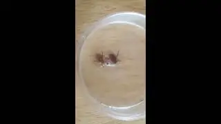 Лучшее средство от клещей своими руками.
