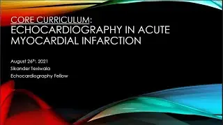 Echocardiography in the setting of acute myocardial infarction