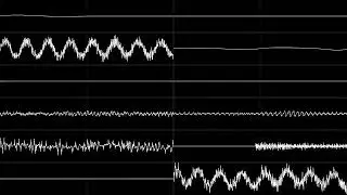 nerve agent beach party remix (UltraBox)