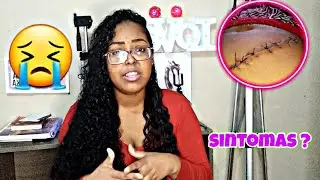 Retirei Minha vesícula | Relato cirurgia de pedra na vesícula