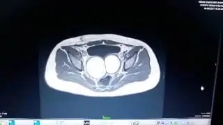 video 1501866185