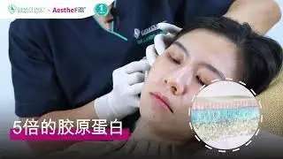 比其他护理刺激更多的胶原蛋白生成 #Aesthefill Advance