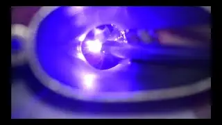 TruBlue 445 nm Laser Assisted Endoscopic Repair of Type IIIa Laryngeal Cleft